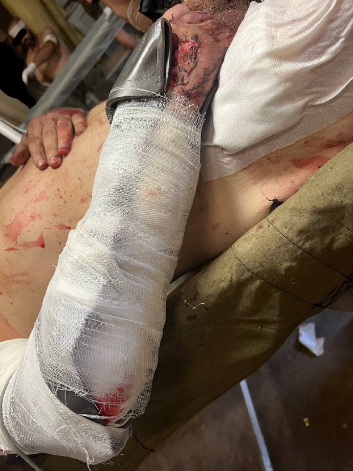 IM电竞游戏平台-队员受伤频发,球队整体作战受损怎么办